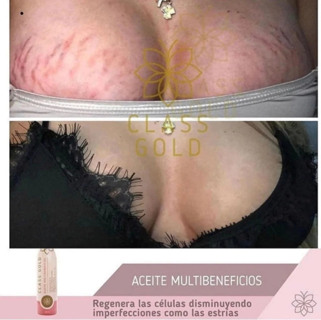 ACEITE MULTIBENEFICIOS CLASS GOLD 120ML