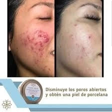 MASCARILLA DE ARCILLA CLASS GOLD PARA EL ROSTRO 150GRS